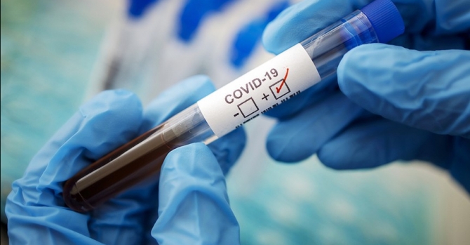COVID-19 In Belarus: 8,773 Infected, +751 People In 24 Hours