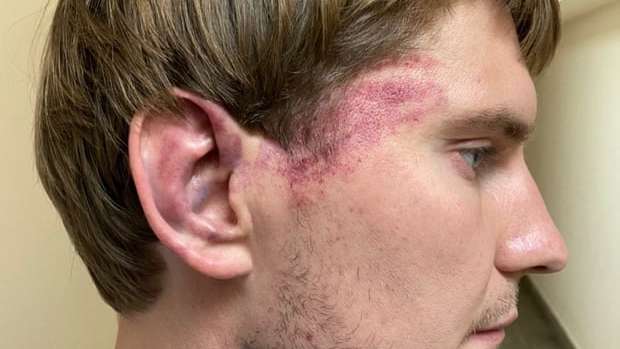 Belarusians seek justice for brutal beatings by riot police